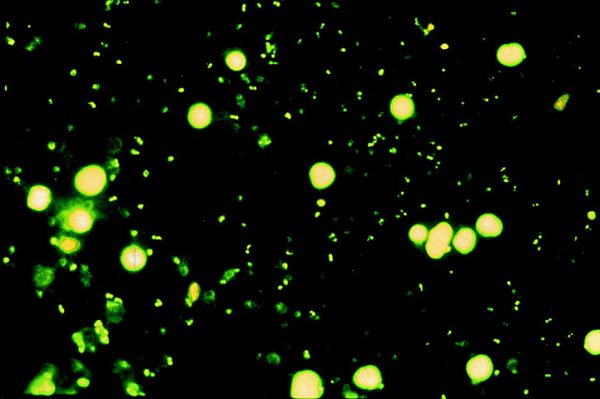 Microscopio para laboratorio Optika B-293LD1 - Imagen 2
